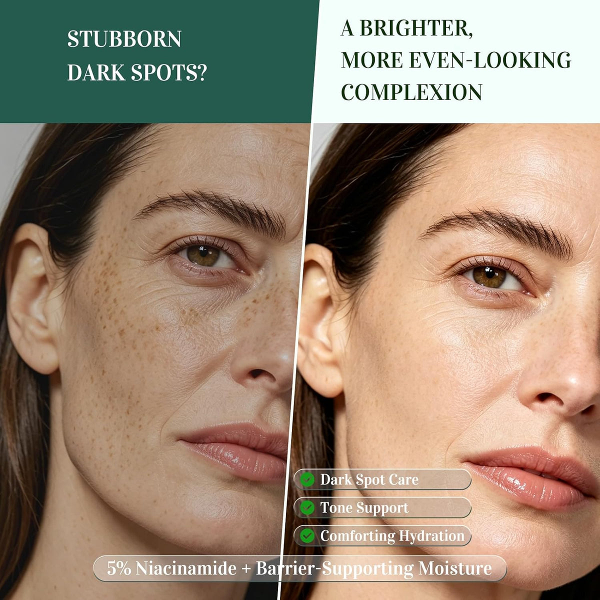 Dark Spot Remover for Face: 5% Niacinamide for Sun & Age Spots