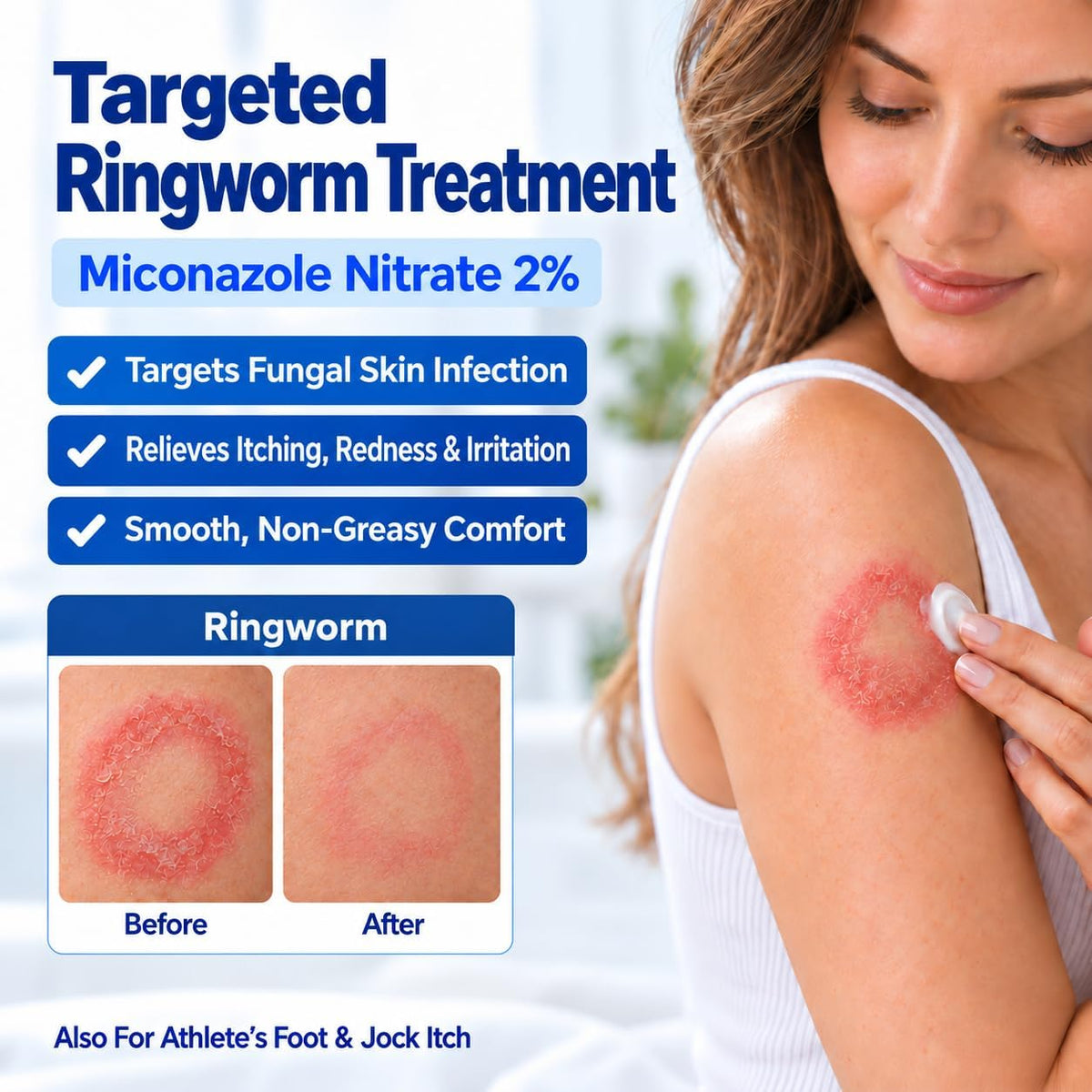 Antifungal Ringworm Treatment Cream: Miconazole Nitrate 2%