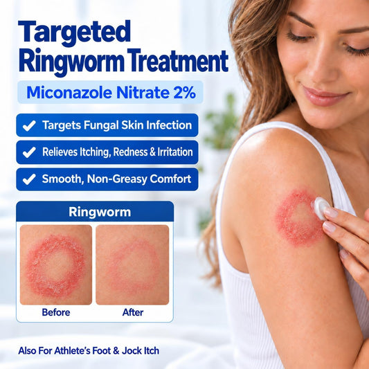 Antifungal Ringworm Treatment Cream: Miconazole Nitrate 2%