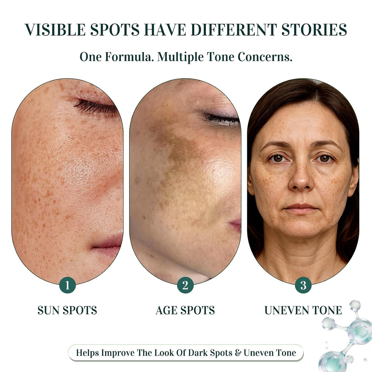 Dark Spot Remover for Face: 5% Niacinamide for Sun & Age Spots