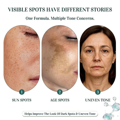 Dark Spot Remover for Face: 5% Niacinamide for Sun & Age Spots