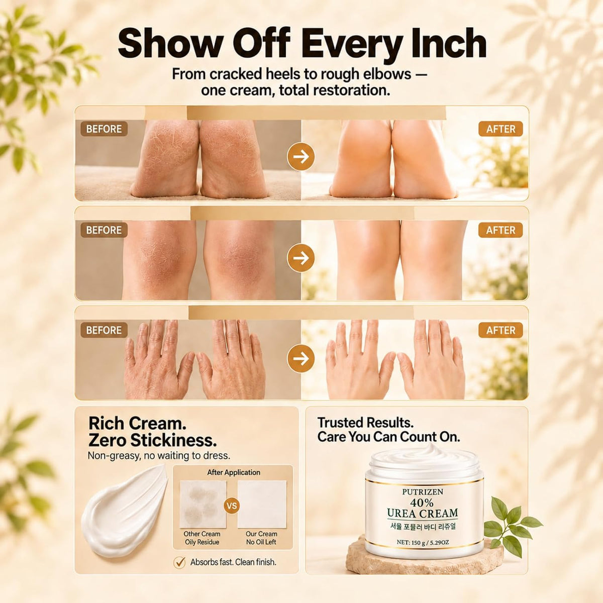 Urea Cream Foot Cream: for Dry Cracked Heels and Feet