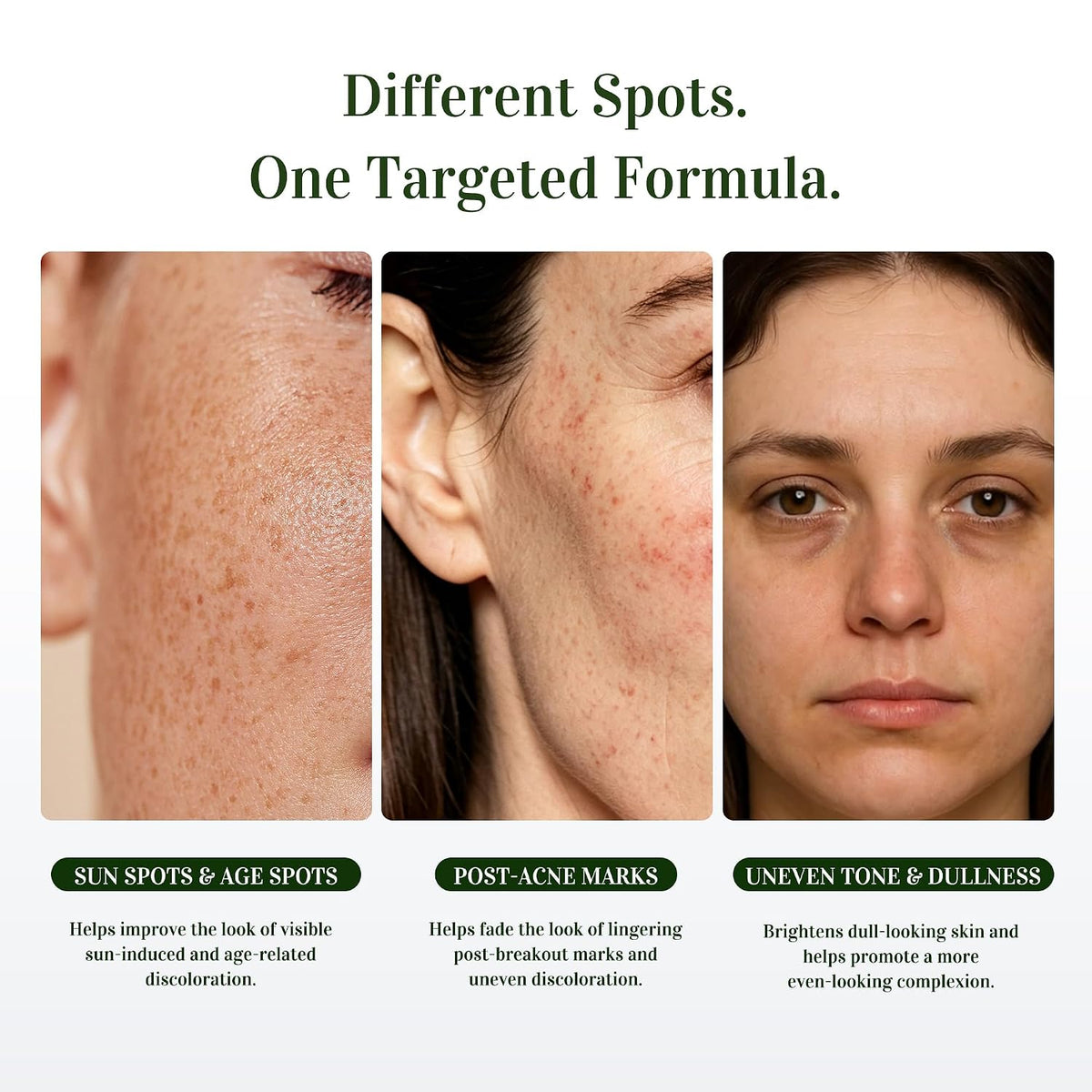 Dark Spot Remover for Face, 5% Niacinamide + 2% Tranexamic Acid, 1.7 FL OZ