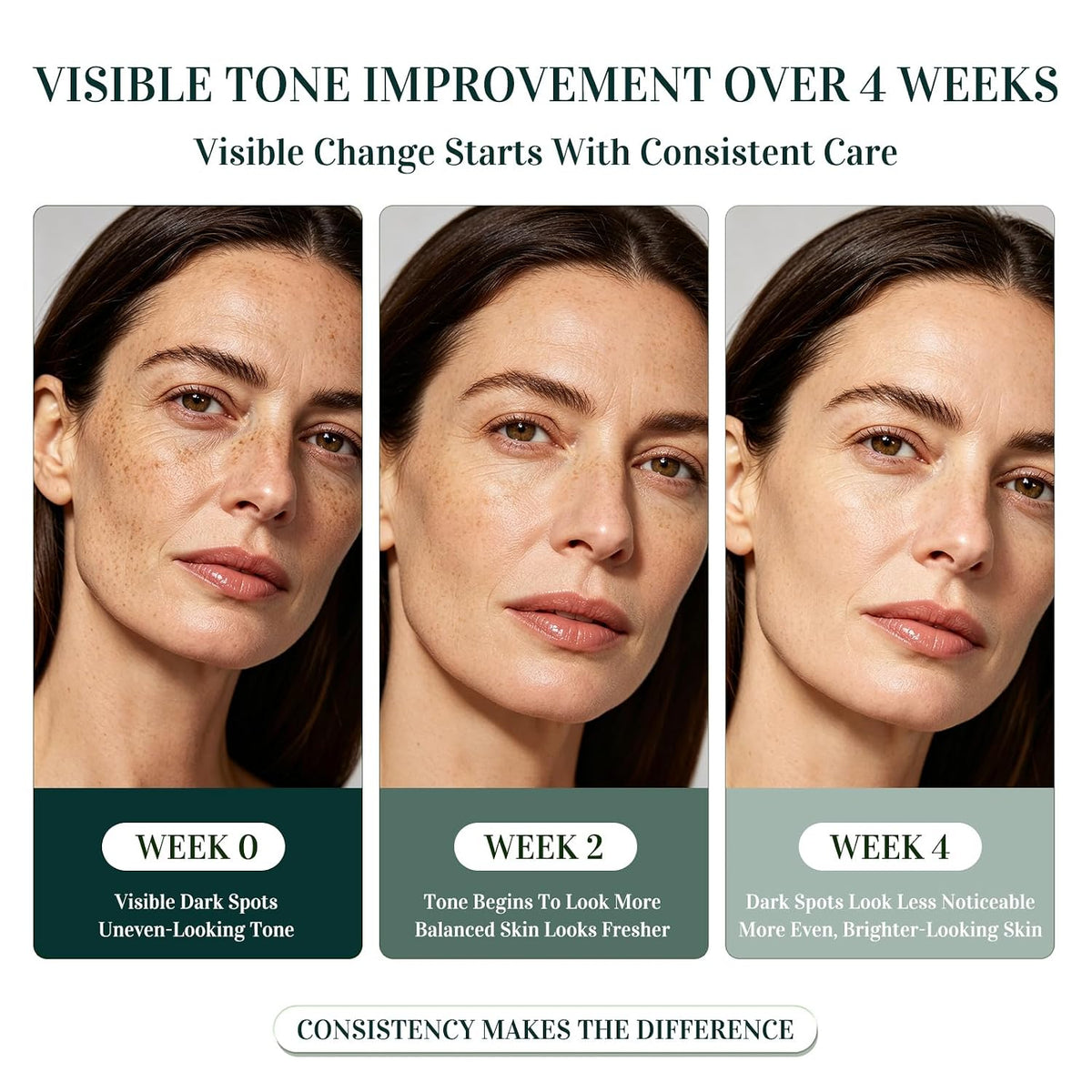 Dark Spot Remover for Face: 5% Niacinamide for Sun & Age Spots